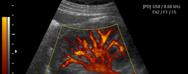 Kerbi Guevara: tu experto en cirugía vascular - Error 404 - ecografia doppler