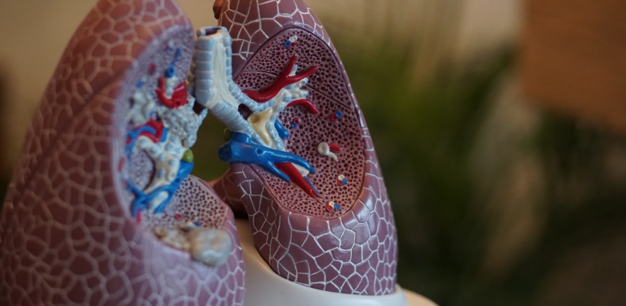 Kerbi Guevara: tu experto en cirugía vascular - Error 404 - investigacion embolia pulmonar