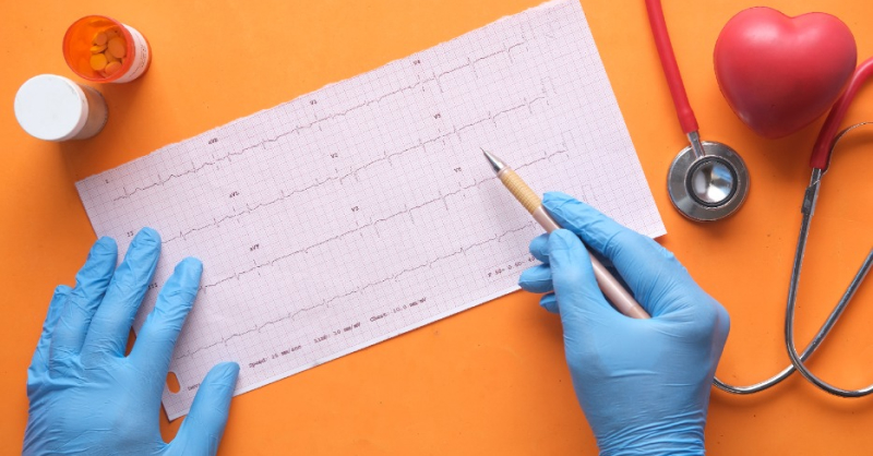 Kerbi Guevara: tu experto en cirugía vascular - Error 404 - programa rehabilitaacion cardiaca