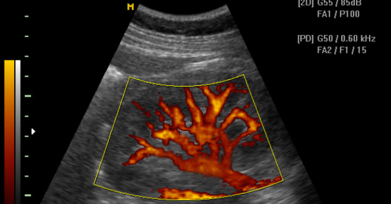 Kerbi Guevara: tu experto en cirugía vascular - Error 404 - servicio ecografia doppler